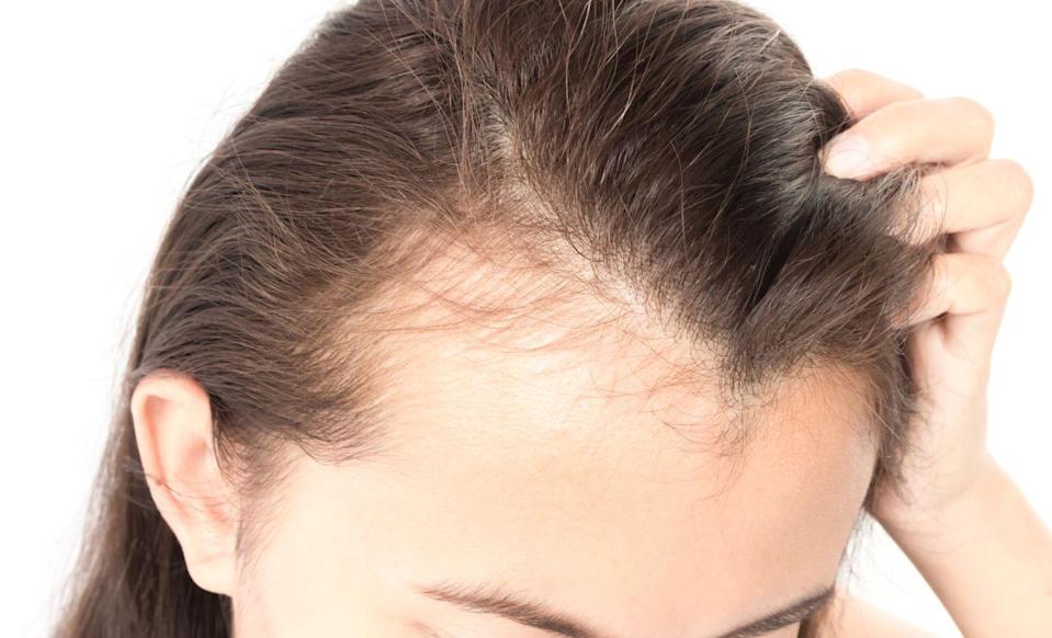 7 Common Scalp Issues â And How to Treat Them