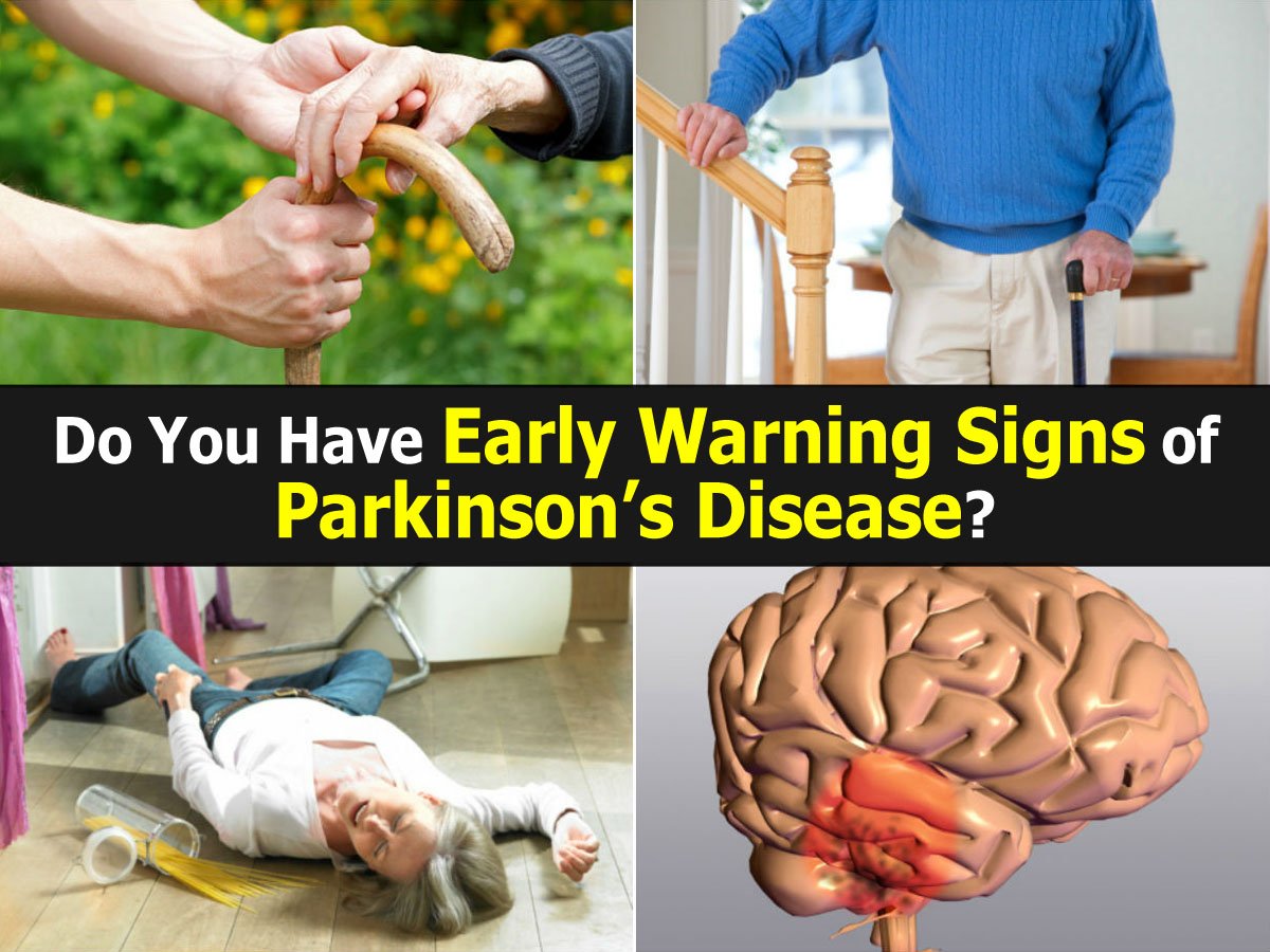 Do You Have Early Warning Signs of Parkinsonâs Disease?