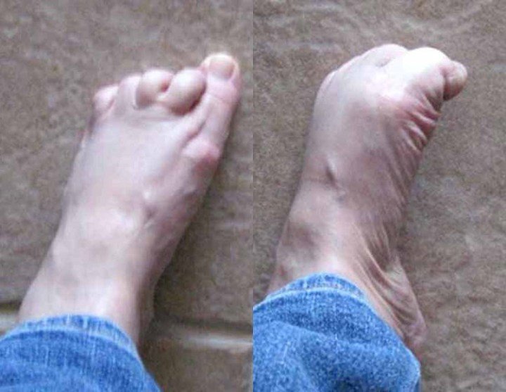 Do you how what happens when you get foot cramps?