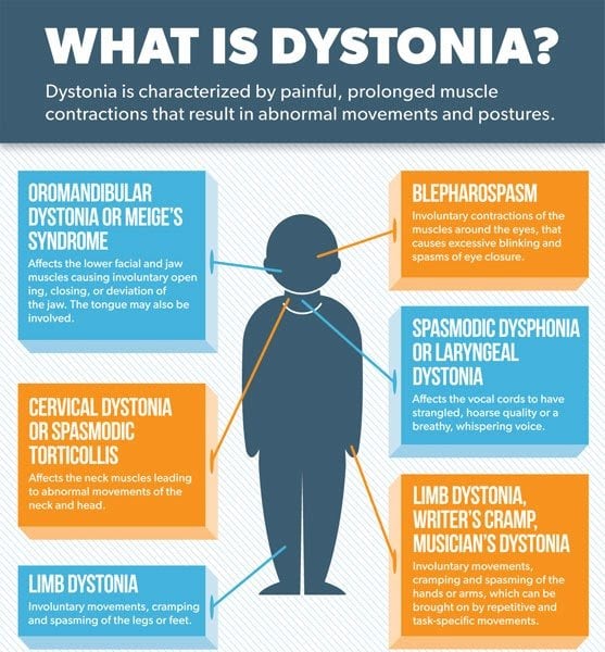 Doctor Pistachio: Cervical Dystonia