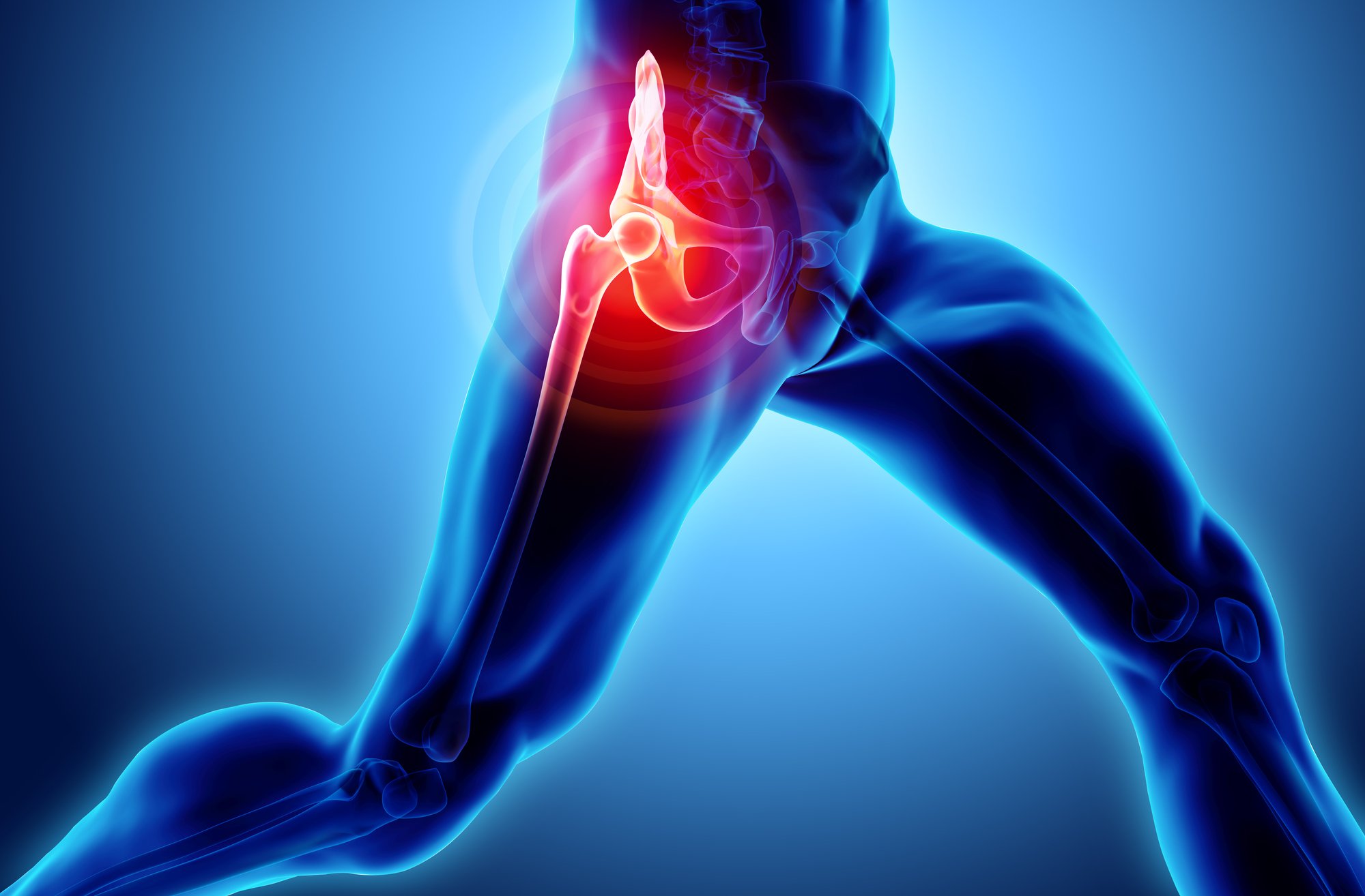 Does Your Hip Hurt? The Cause of Your Hip Pain May Not Be ...