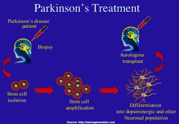 Drugs For Parkinsons Disease  Article Tools