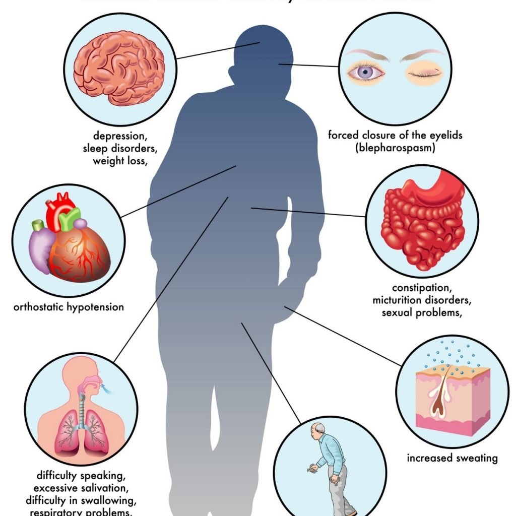 Early Symptoms Of Parkinson