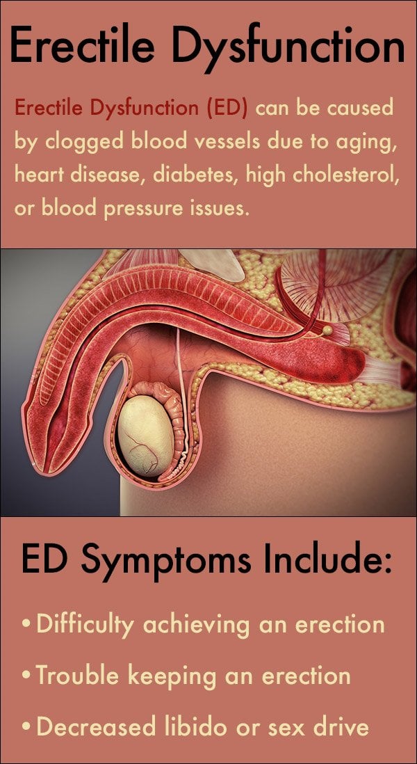 Erectile Dysfunction Treatment  What Causes ED Symptoms ...