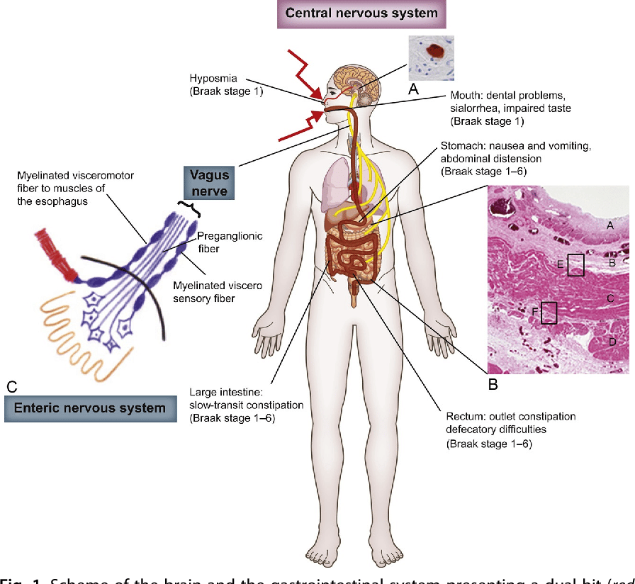 Figure 1 from The Gut and Nonmotor Symptoms in Parkinson
