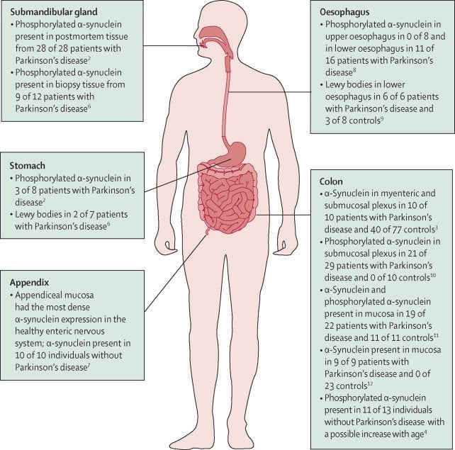 Gastrointestinal dysfunction in Parkinson