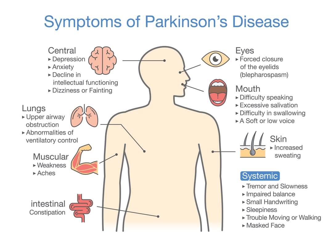 Hope for early detection of Parkinson