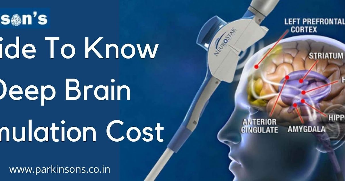 Information Of Deep Brain Stimulation Cost