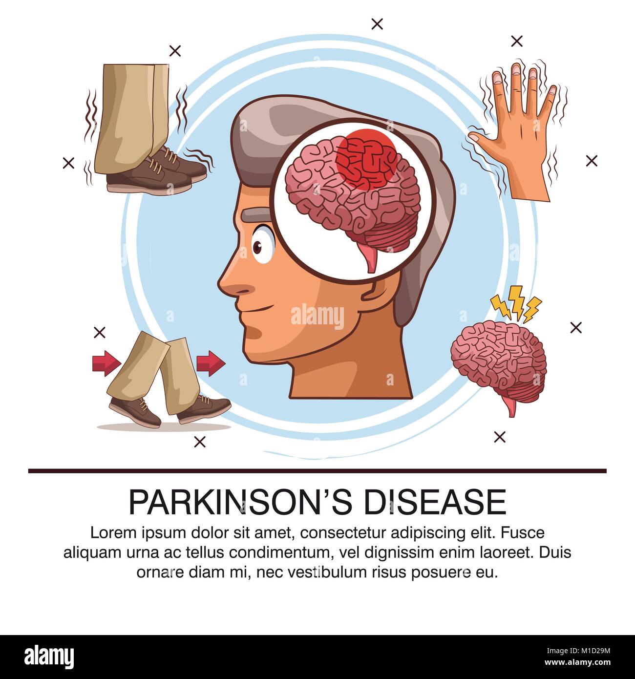 Parkinson Brain Cut Out Stock Images &  Pictures