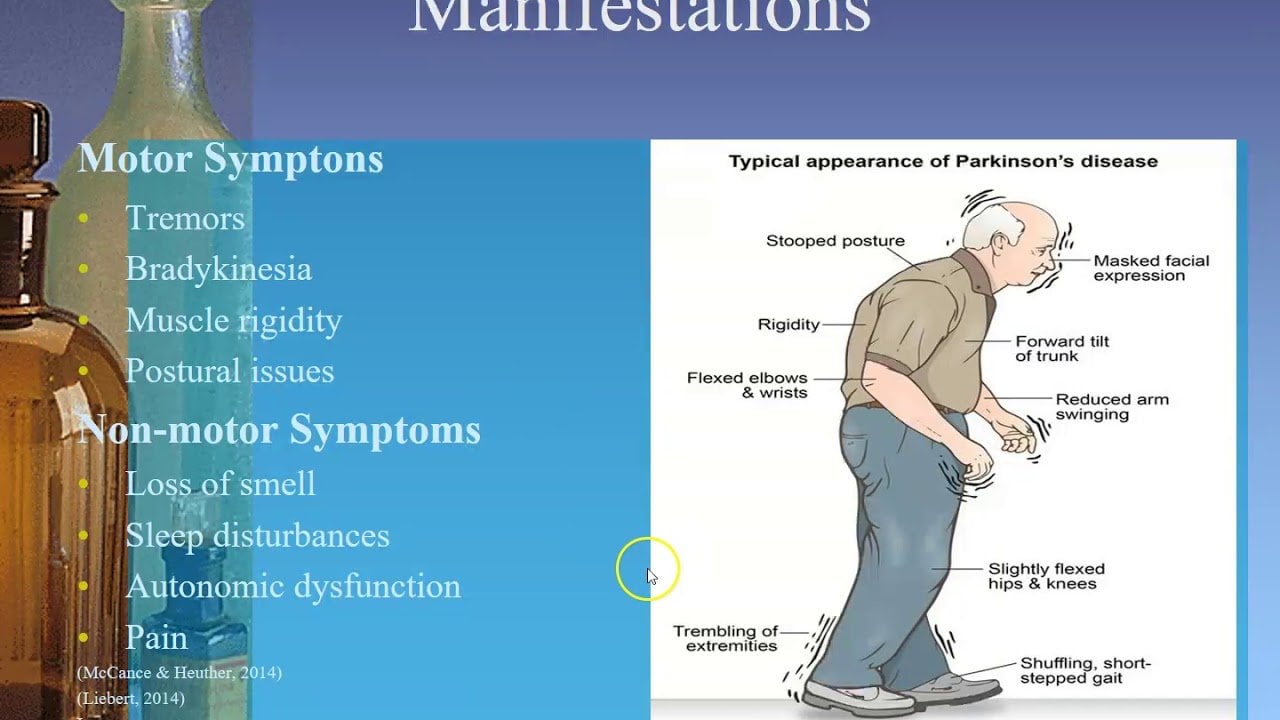 Parkinson Disease Case Presentation