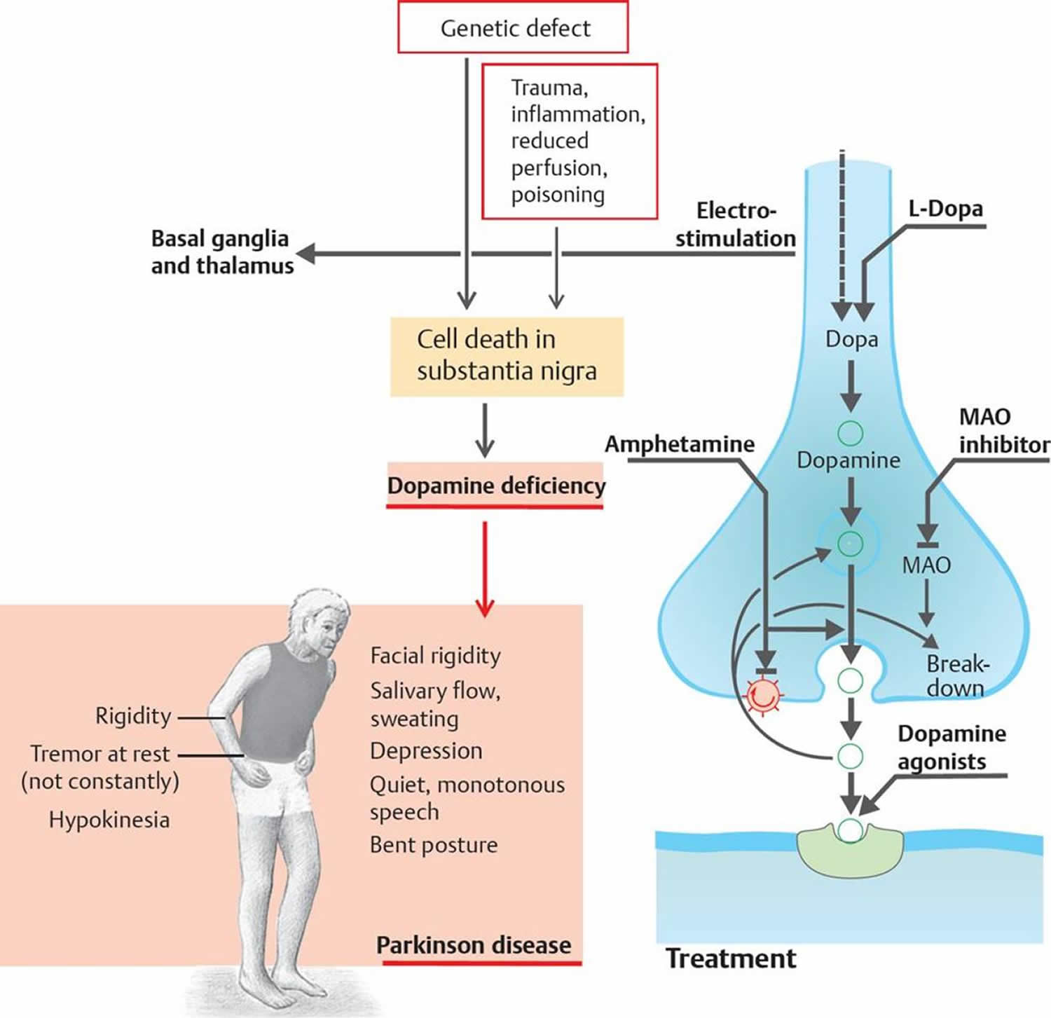 Parkinsons And Dopamine : Impaired dopamine metabolism in Parkinsons ...