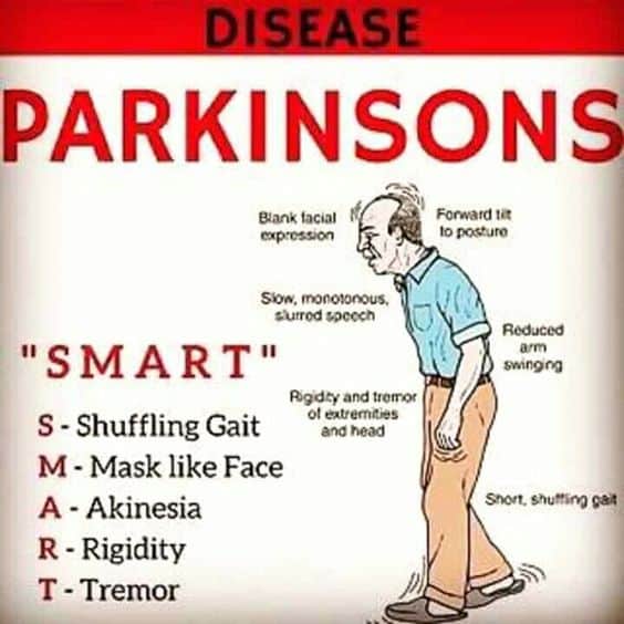 Parkinsons Disease Causes A Shuffling Gait And A Mask Like Facial ...