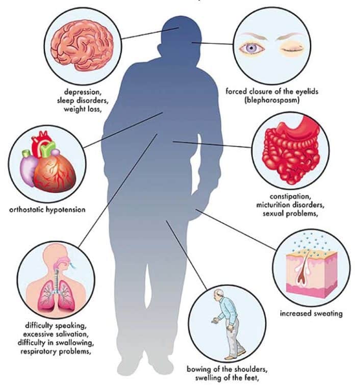 Parkinsons disease Causes, Symptoms and Treatment