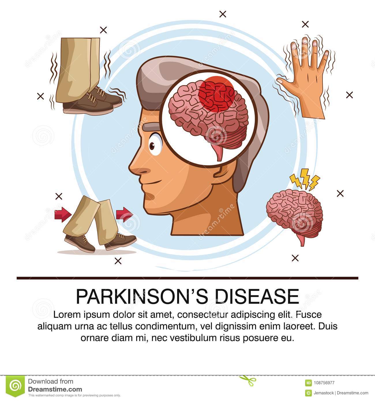 Parkinsons Disease Infographic Stock Vector