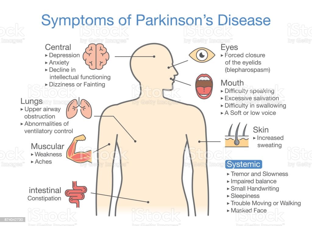 Parkinsons Disease Symptoms And Signs Stock Illustration