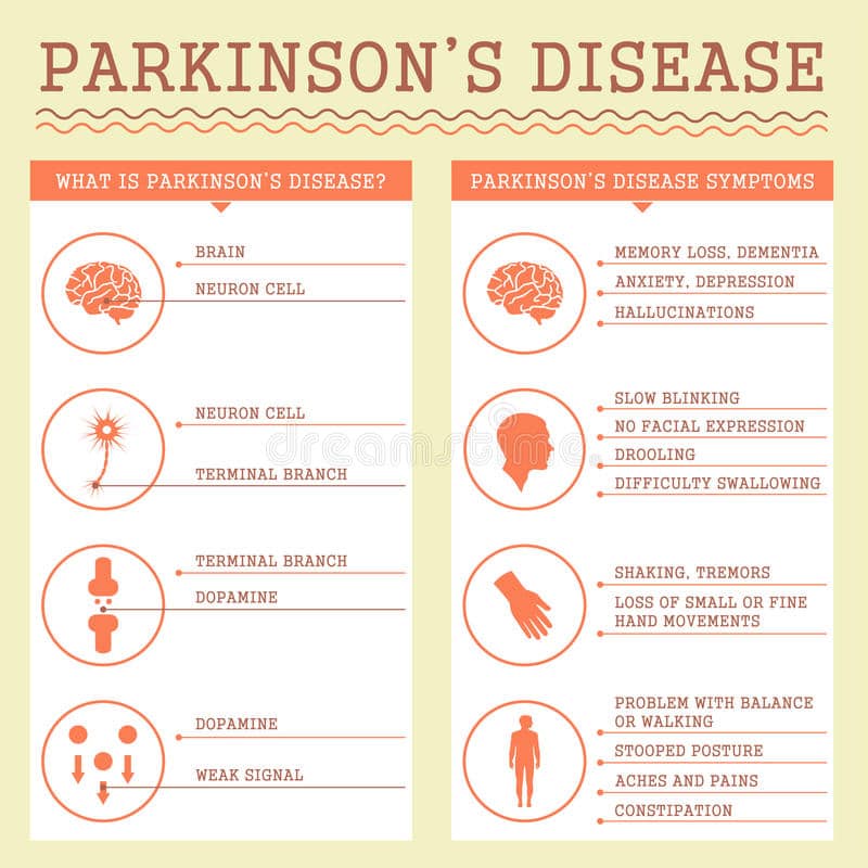 Parkinsons Disease Symptoms, Stock Vector