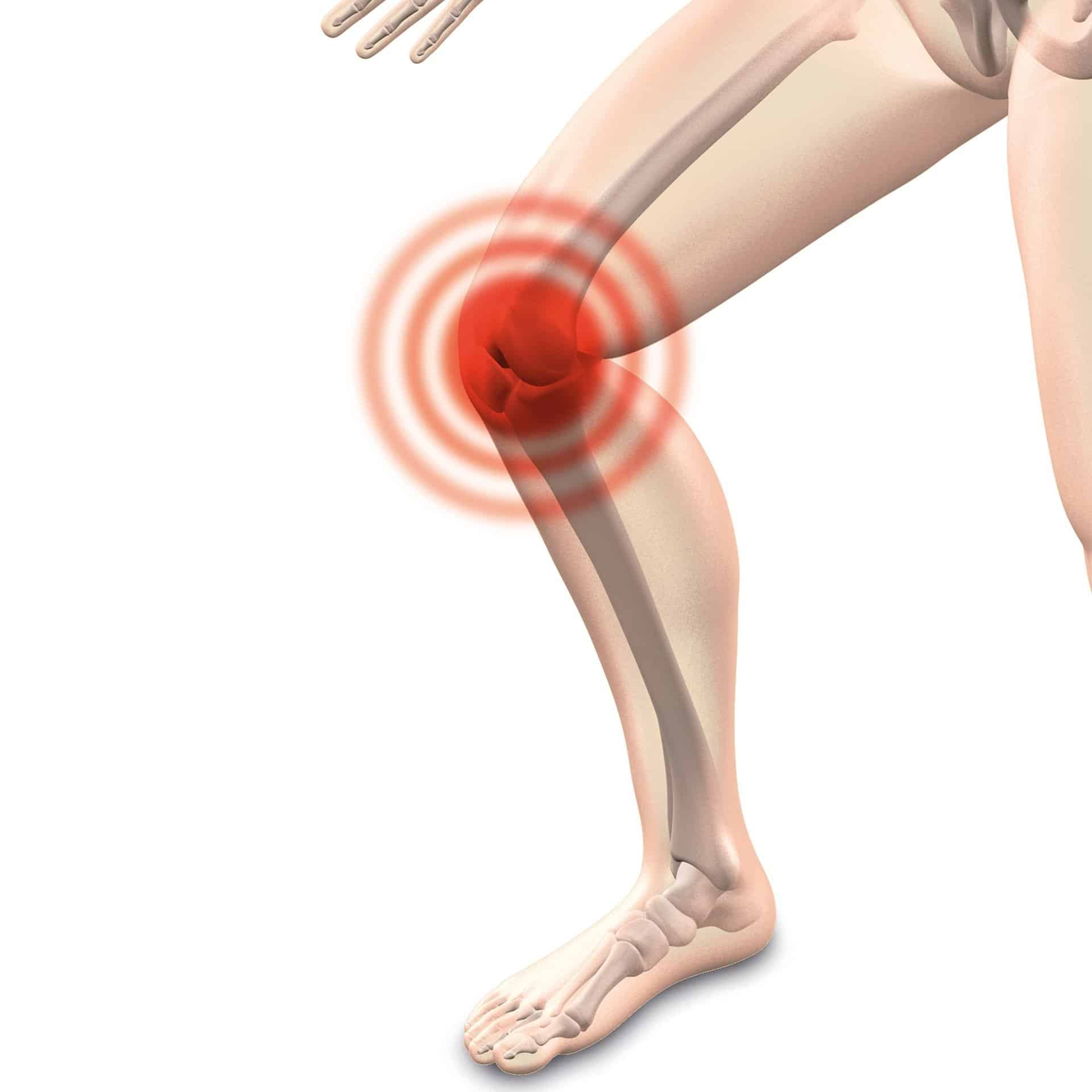 Risk of serious complications during knee replacement 73% higher when a ...