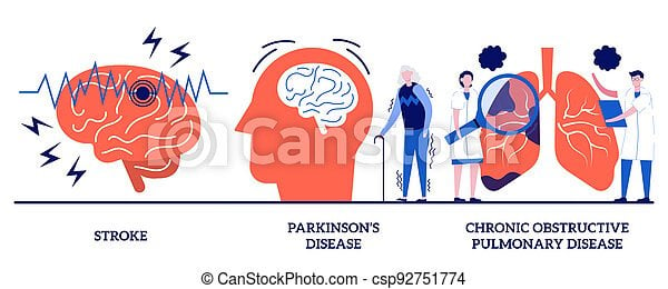 Stroke and parkinson disease tremor, chronic obstructive ...