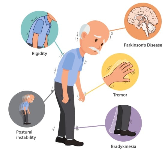 treatment of postural instability in parkinson