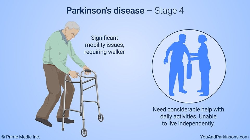 Understanding Parkinsons Disease