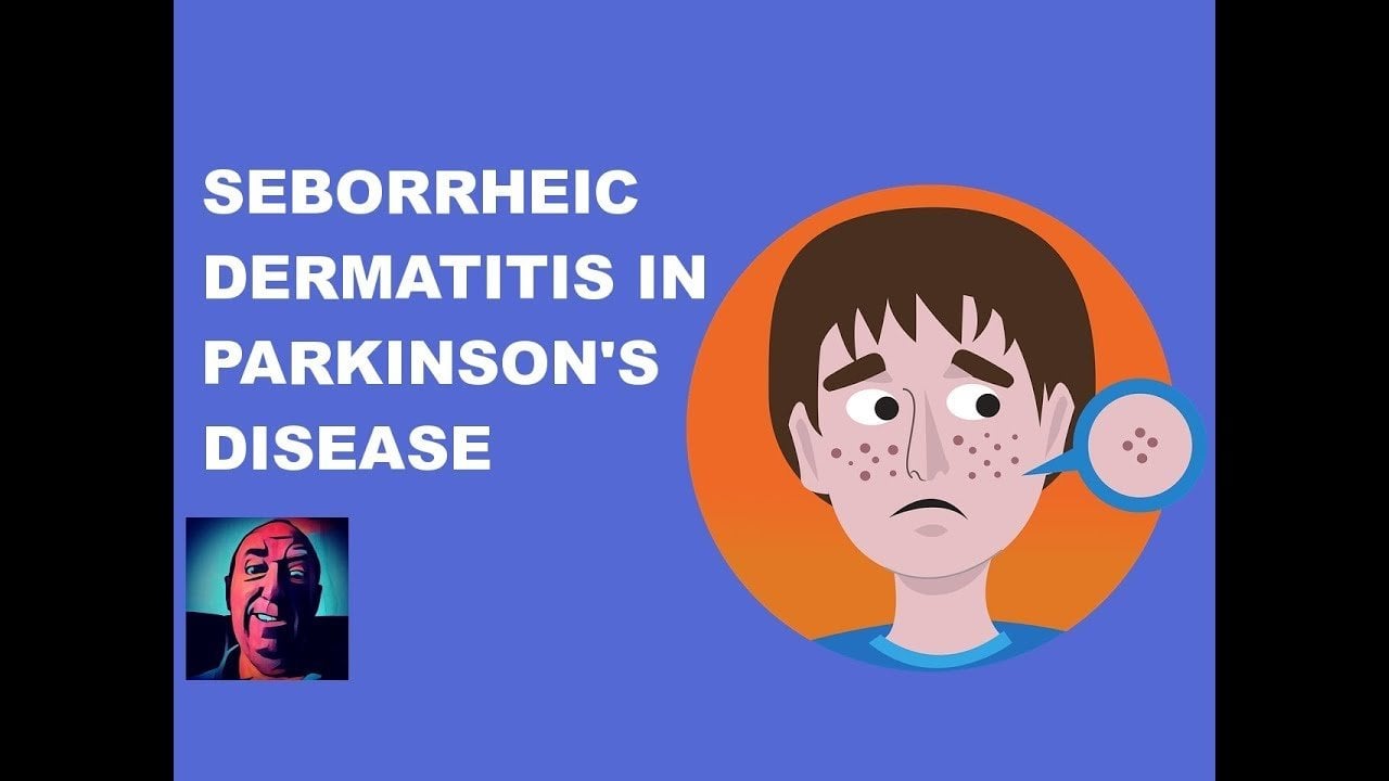 Vlog #138 Seborrheic Dermatitis In Parkinson