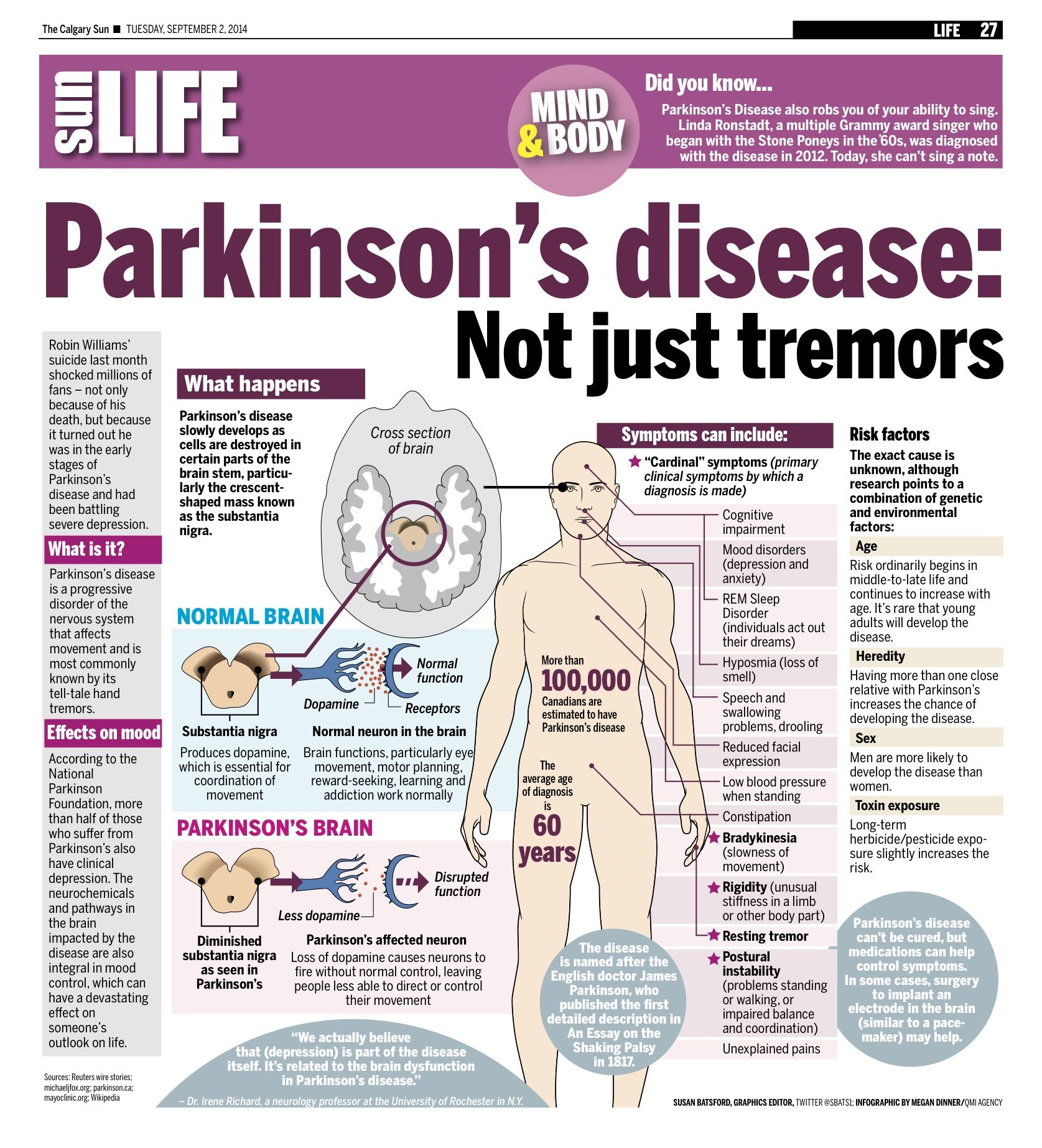 What Are The Early Stages Of Parkinson