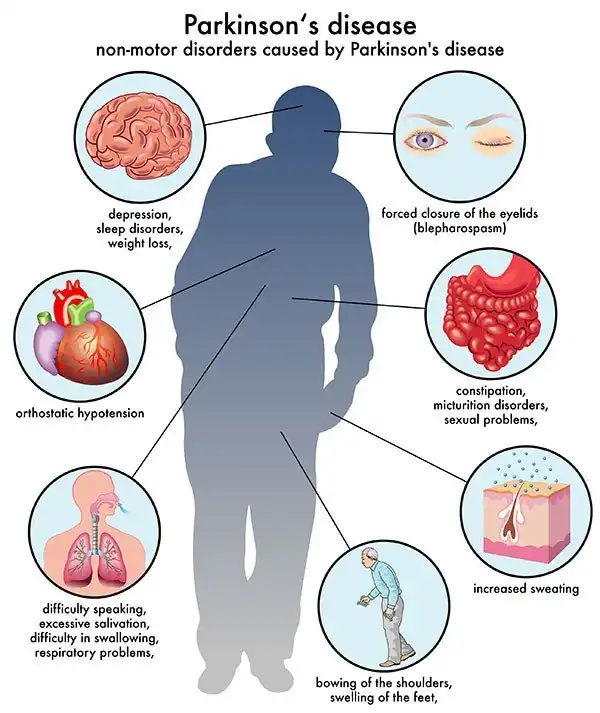 What Are The Symptoms To Parkinson